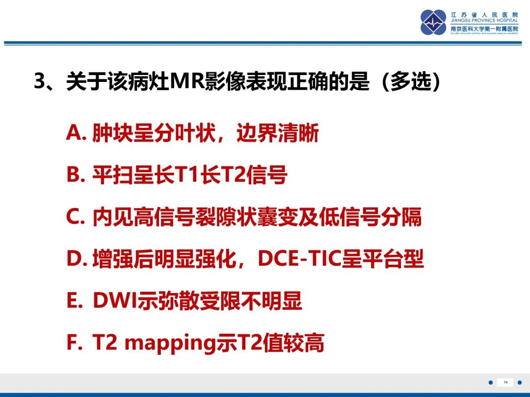 影像PPT - 【PPT】乳腺叶状肿瘤-15