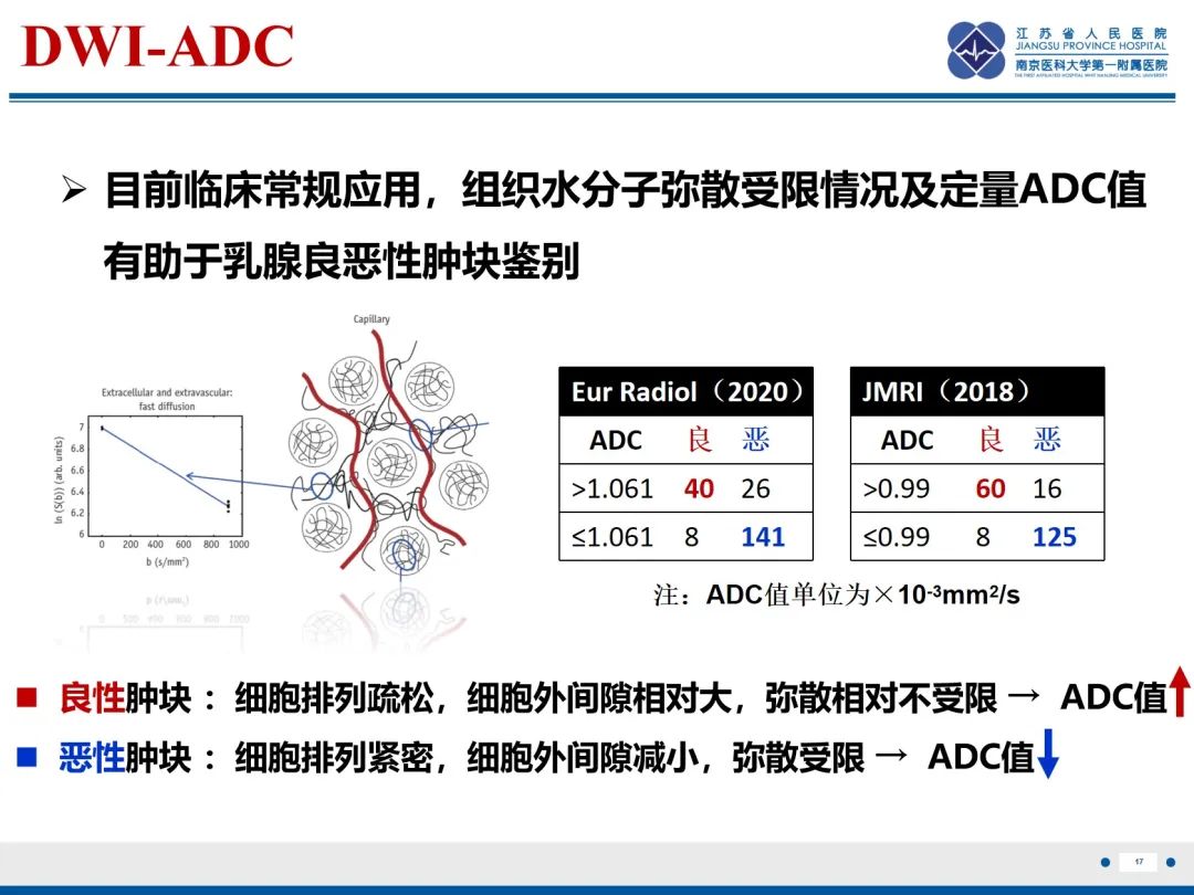 影像PPT - 【PPT】乳腺叶状肿瘤-18
