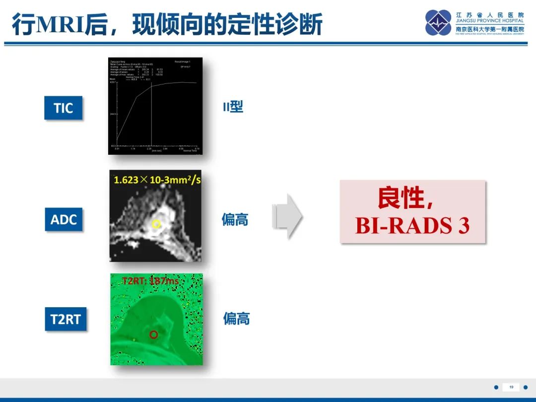 影像PPT - 【PPT】乳腺叶状肿瘤-20
