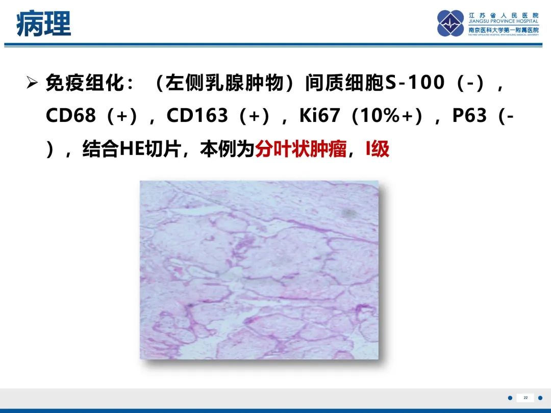 影像PPT - 【PPT】乳腺叶状肿瘤-23