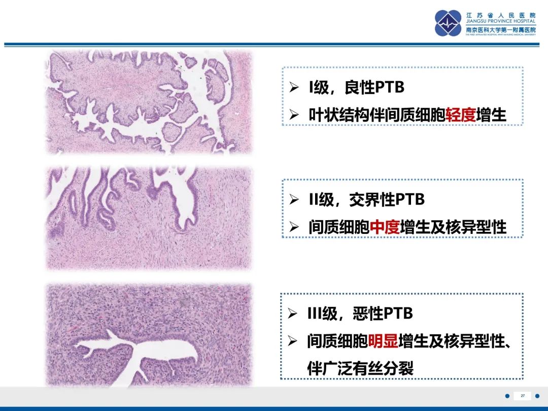 影像PPT - 【PPT】乳腺叶状肿瘤-28
