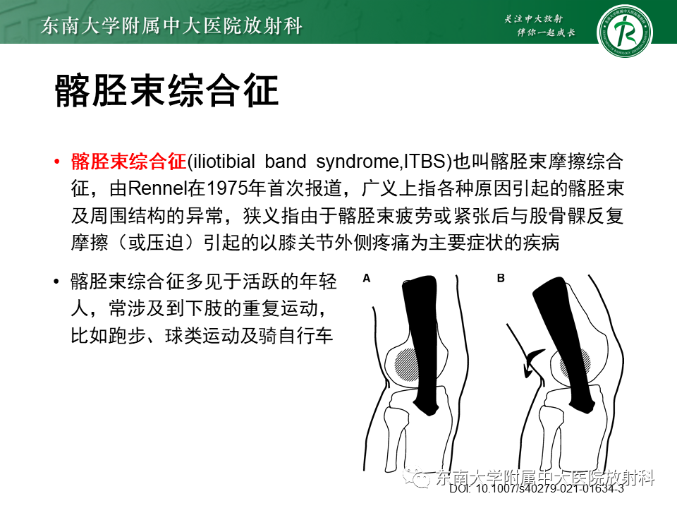影像PPT - 【PPT】髂胫束相关损伤-11