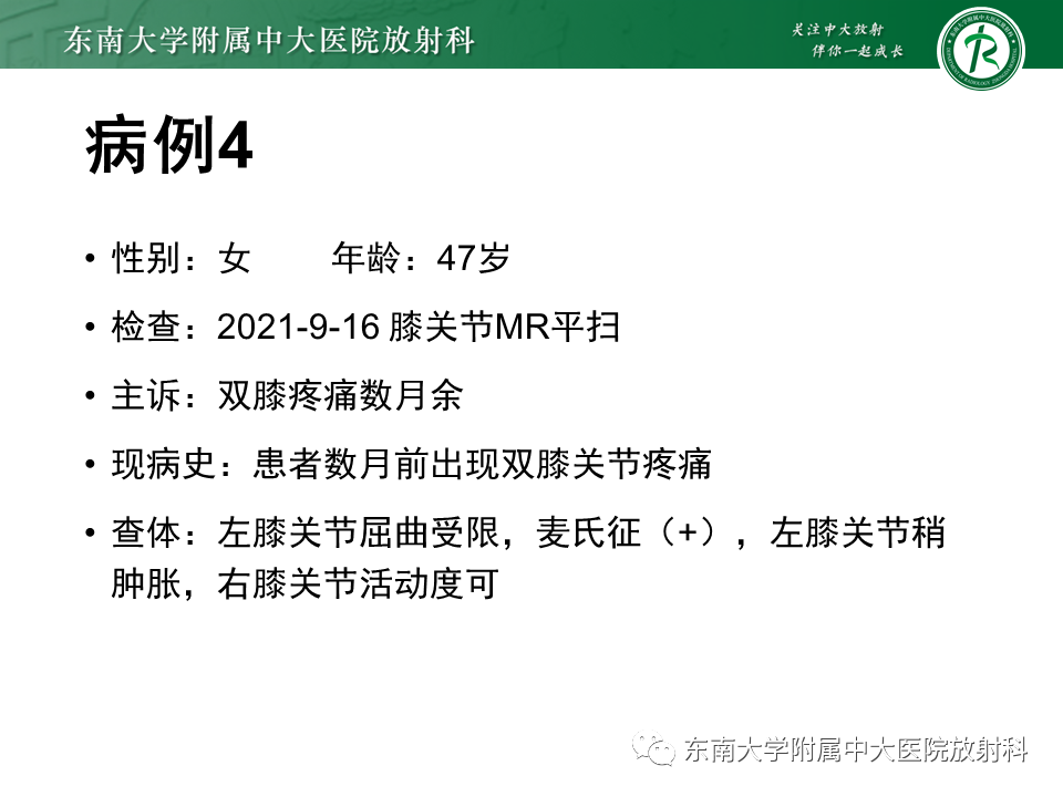 影像PPT - 【PPT】髂胫束相关损伤-37