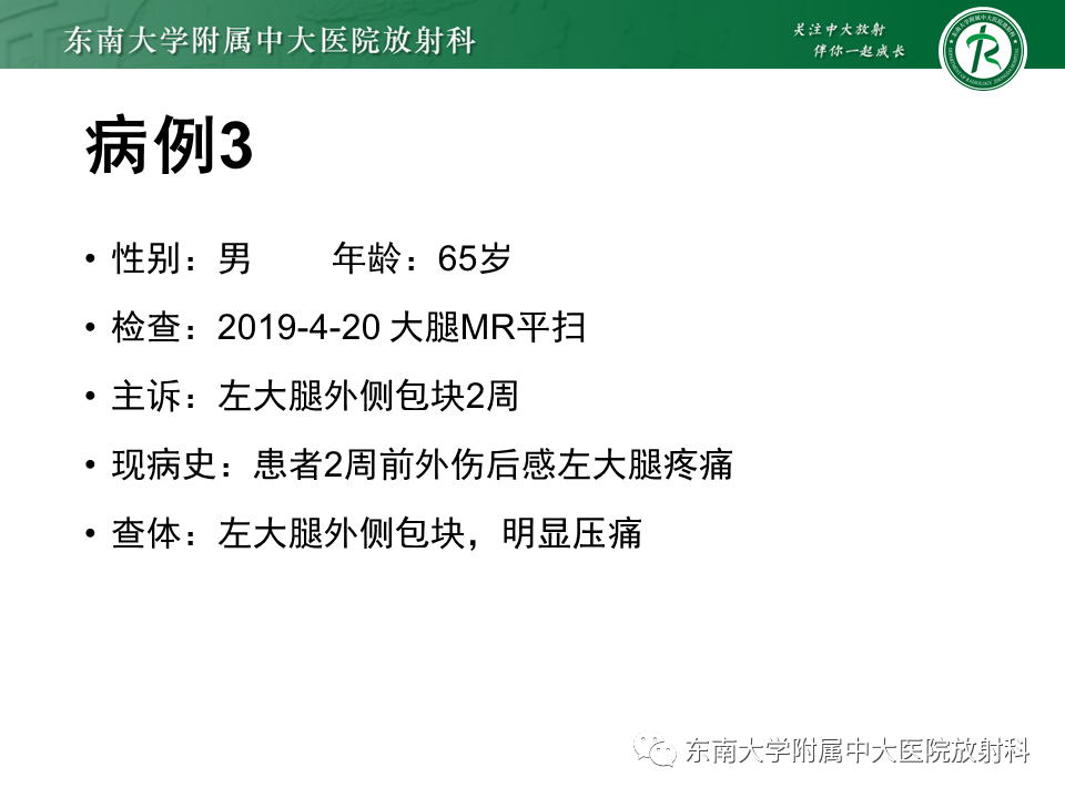 影像PPT - 【PPT】髂胫束相关损伤-25
