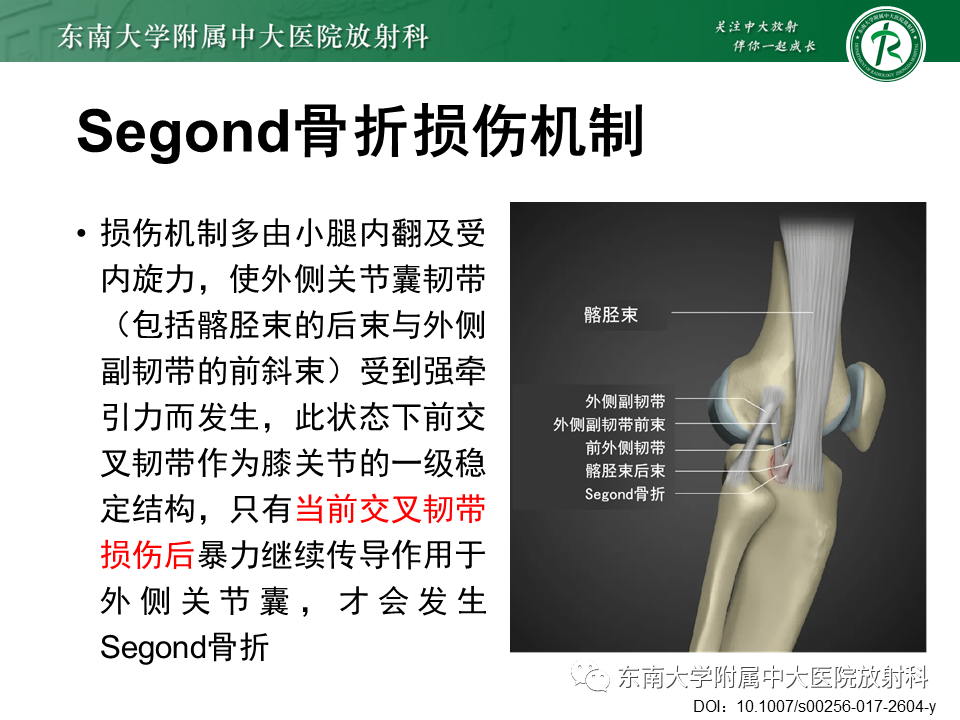 影像PPT - 【PPT】髂胫束相关损伤-48