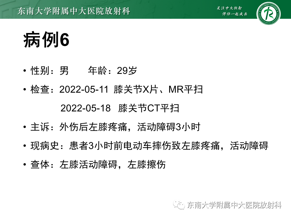 影像PPT - 【PPT】髂胫束相关损伤-50