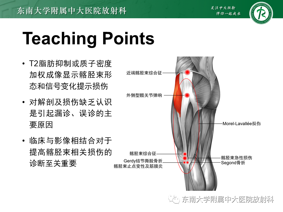 影像PPT - 【PPT】髂胫束相关损伤-53