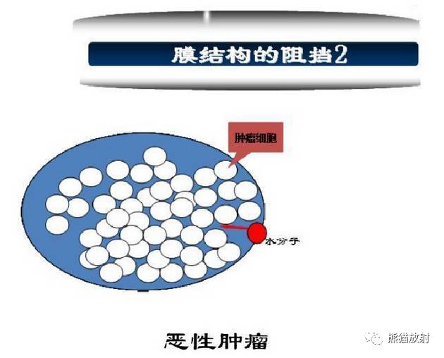 影像PPT - MR入门—手把手教你看DWI和ADC图-5 影像PPT - MR入门—手把手教你看DWI和ADC图-5