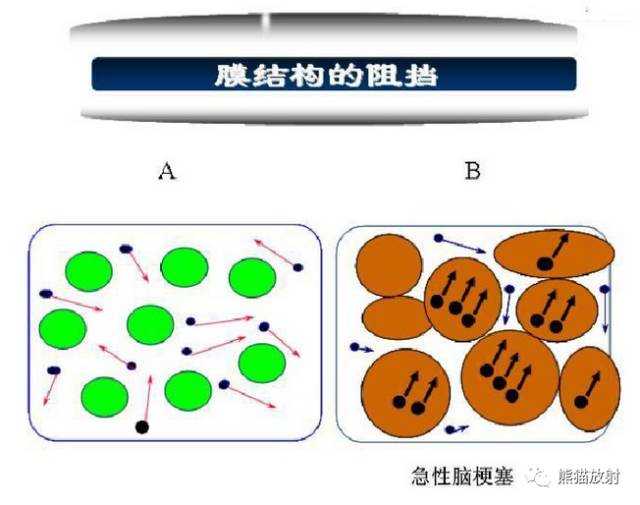 影像PPT - MR入门—手把手教你看DWI和ADC图-4 影像PPT - MR入门—手把手教你看DWI和ADC图-4