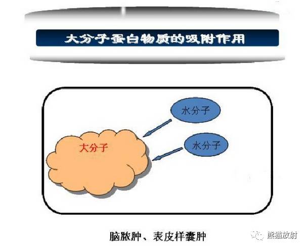 影像PPT - MR入门—手把手教你看DWI和ADC图-6 影像PPT - MR入门—手把手教你看DWI和ADC图-6