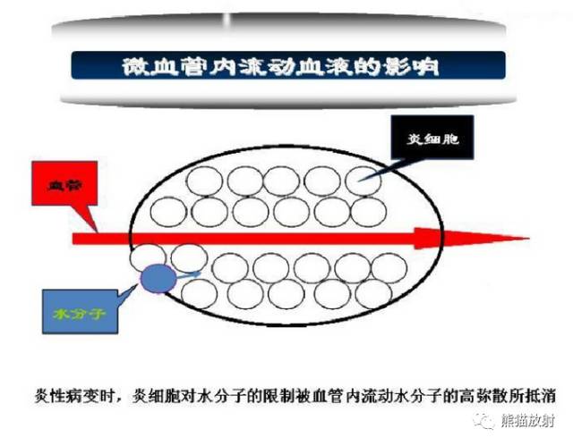 影像PPT - MR入门—手把手教你看DWI和ADC图-7 影像PPT - MR入门—手把手教你看DWI和ADC图-7