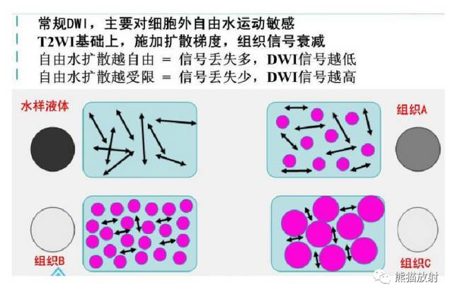 影像PPT - MR入门—手把手教你看DWI和ADC图-9 影像PPT - MR入门—手把手教你看DWI和ADC图-9