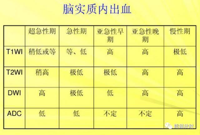 影像PPT - MR入门—手把手教你看DWI和ADC图-36 影像PPT - MR入门—手把手教你看DWI和ADC图-36