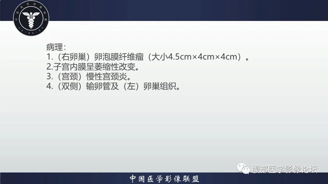 影像PPT - 【病例】卵巢卵泡膜纤维瘤1例CT影像-6