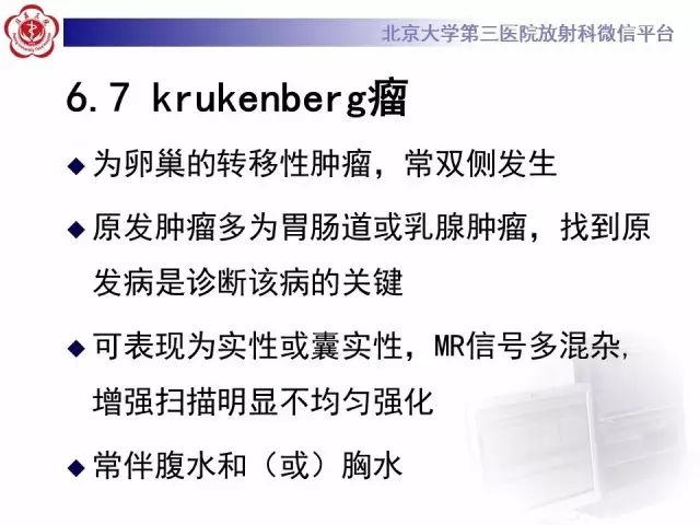 影像PPT - 【病例】卵巢卵泡膜纤维瘤1例CT影像-21