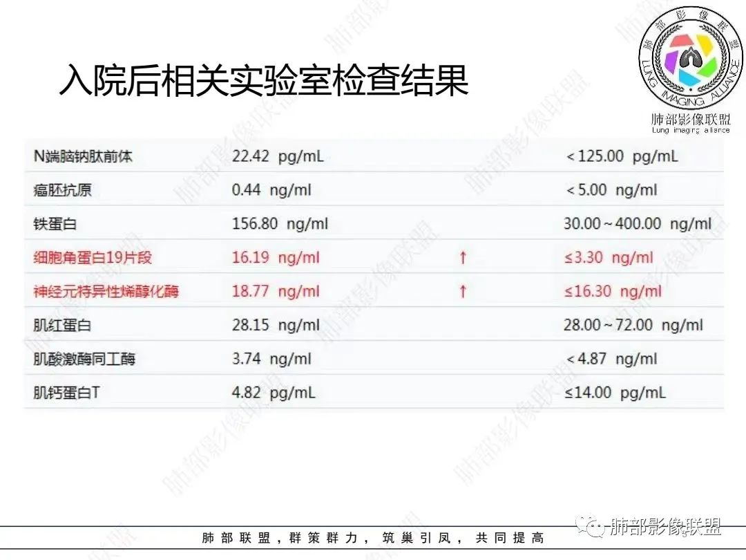 影像PPT - 【病例】胸膜弥漫性连续性增厚—恶性间皮瘤-3 影像PPT - 【病例】胸膜弥漫性连续性增厚—恶性间皮瘤-3