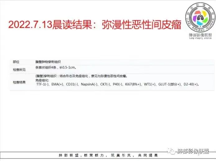 影像PPT - 【病例】胸膜弥漫性连续性增厚—恶性间皮瘤-45 影像PPT - 【病例】胸膜弥漫性连续性增厚—恶性间皮瘤-45