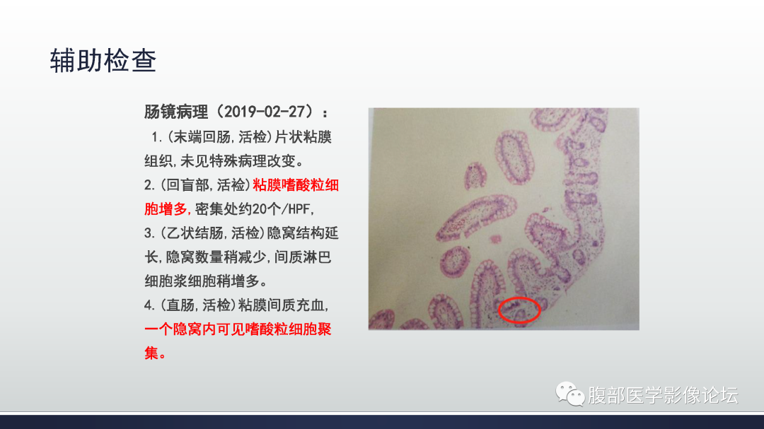 影像PPT - 【病例】嗜酸细胞增多综合征1例CT影像表现-9
