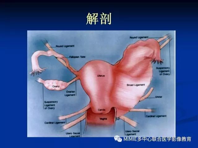 影像PPT - 【PPT】女性生殖系统正常解剖及表现-26