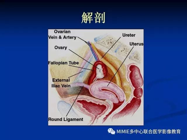 影像PPT - 【PPT】女性生殖系统正常解剖及表现-27