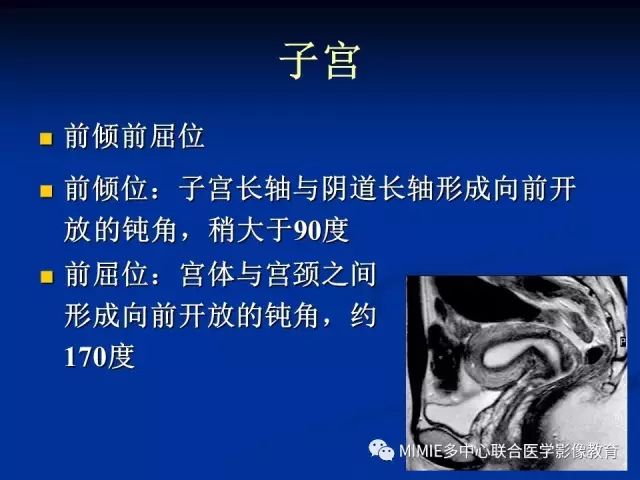 影像PPT - 【PPT】女性生殖系统正常解剖及表现-29