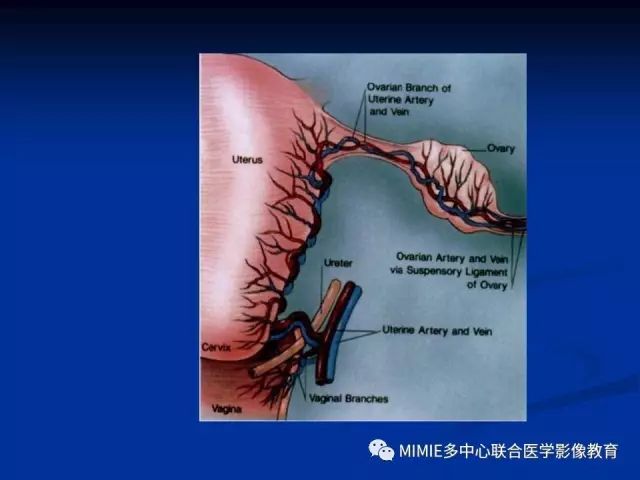 影像PPT - 【PPT】女性生殖系统正常解剖及表现-81
