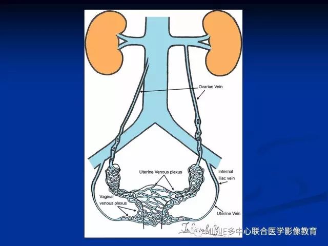 影像PPT - 【PPT】女性生殖系统正常解剖及表现-84