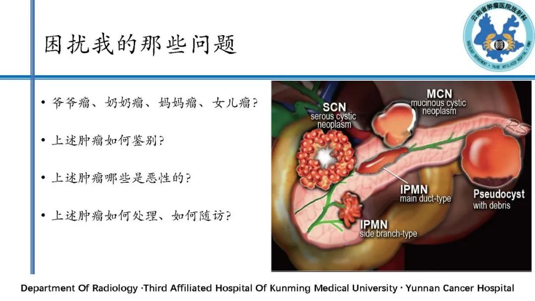 影像PPT - 【PPT】胰腺囊性病变诊断及处理策略-2