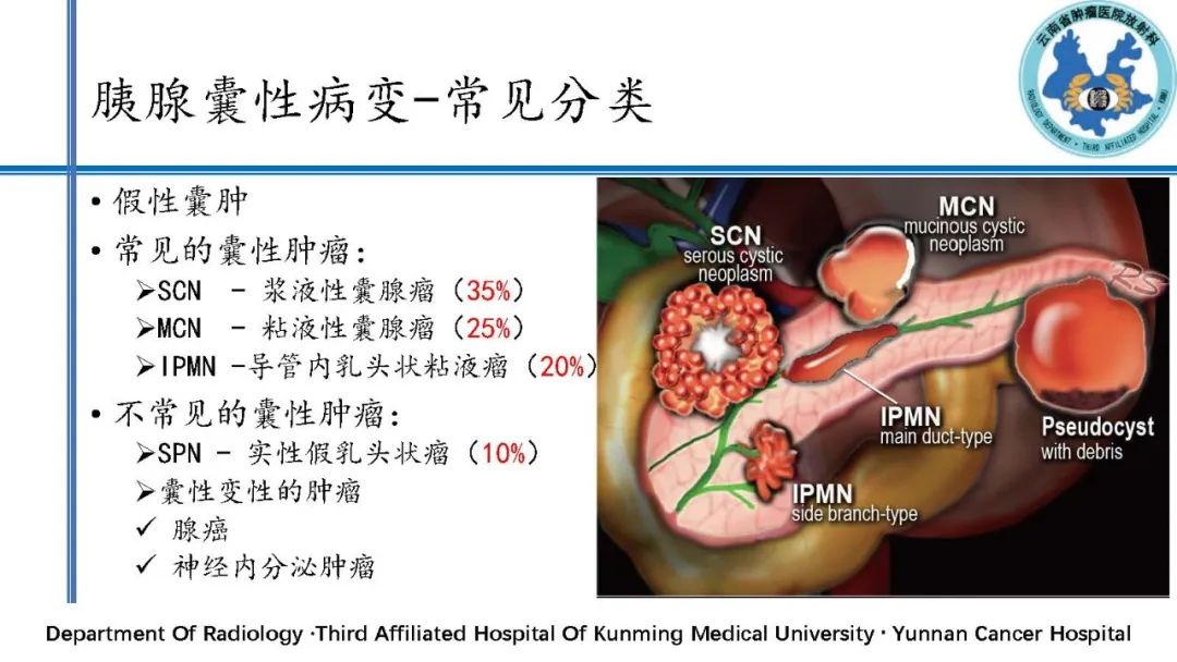 影像PPT - 【PPT】胰腺囊性病变诊断及处理策略-5