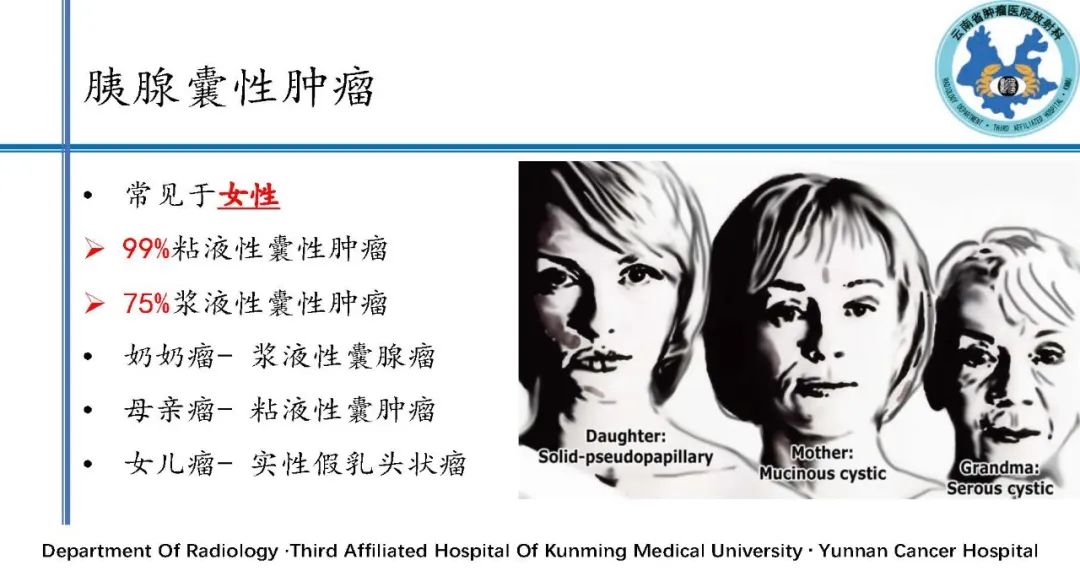 影像PPT - 【PPT】胰腺囊性病变诊断及处理策略-7