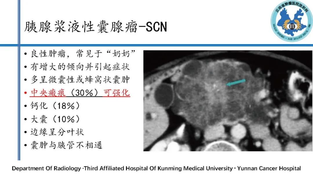 影像PPT - 【PPT】胰腺囊性病变诊断及处理策略-12