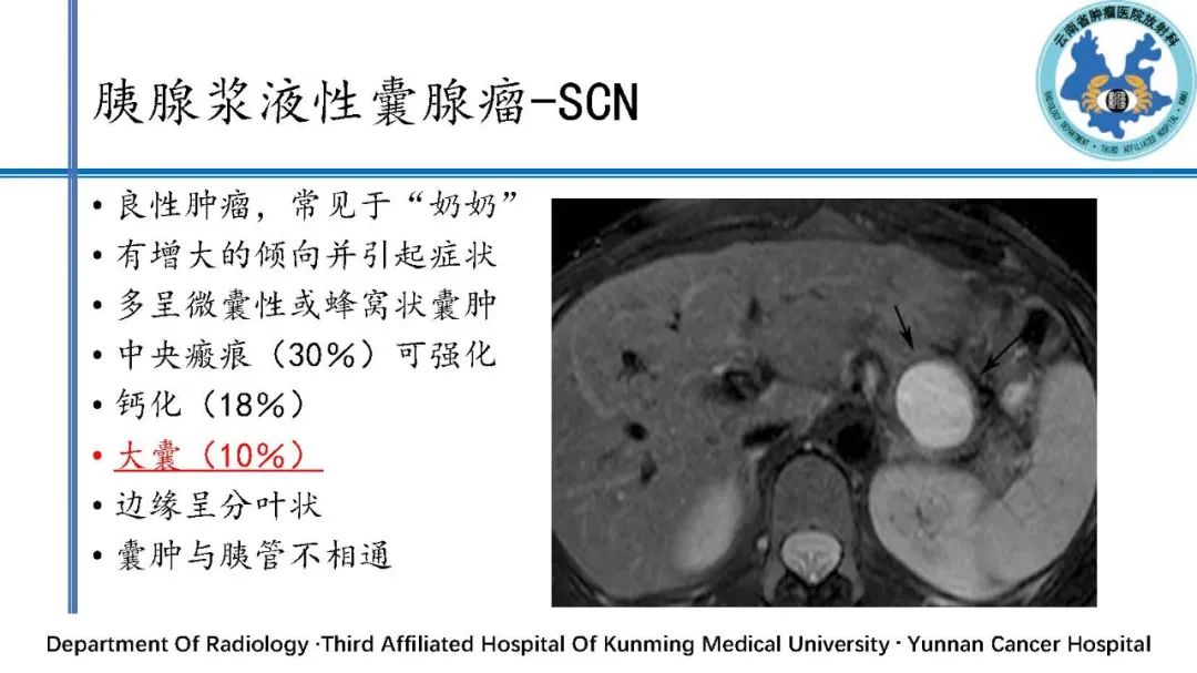 影像PPT - 【PPT】胰腺囊性病变诊断及处理策略-15