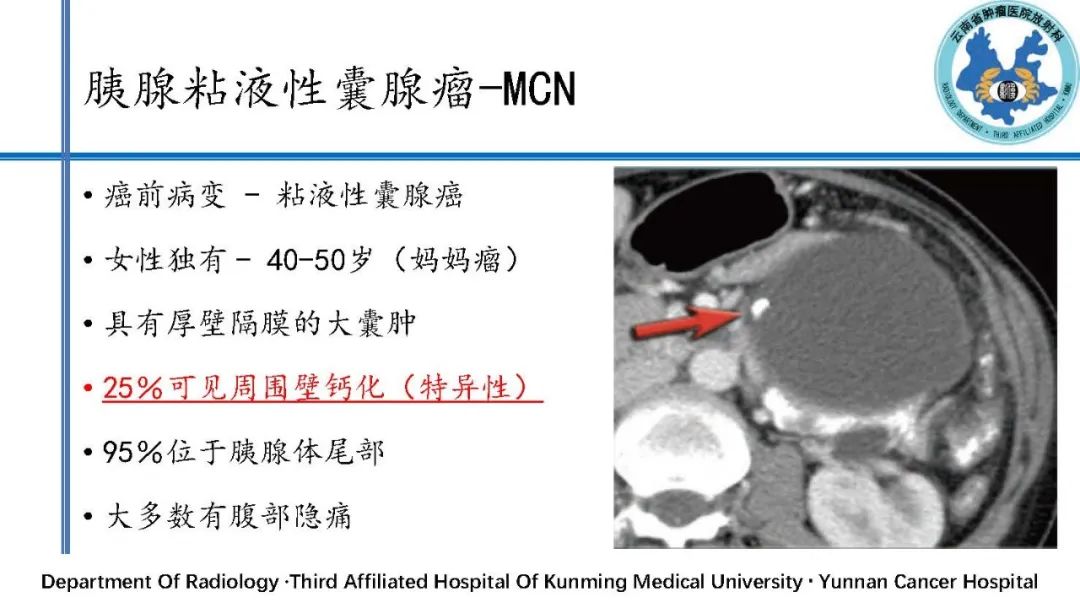 影像PPT - 【PPT】胰腺囊性病变诊断及处理策略-20