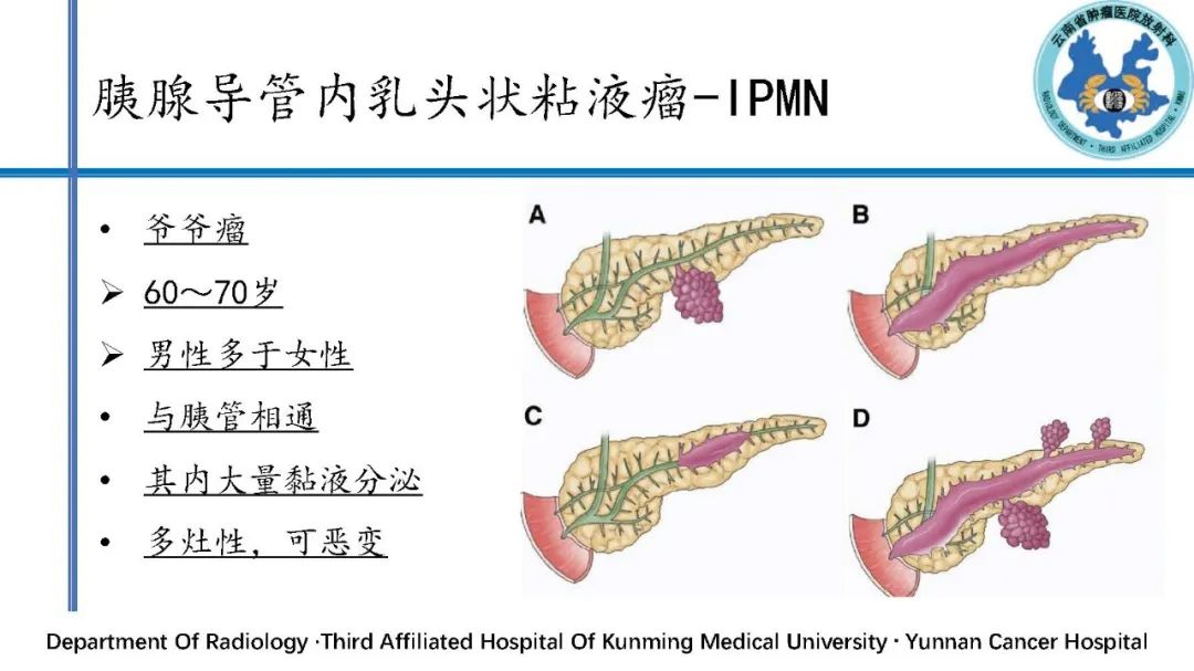 影像PPT - 【PPT】胰腺囊性病变诊断及处理策略-26