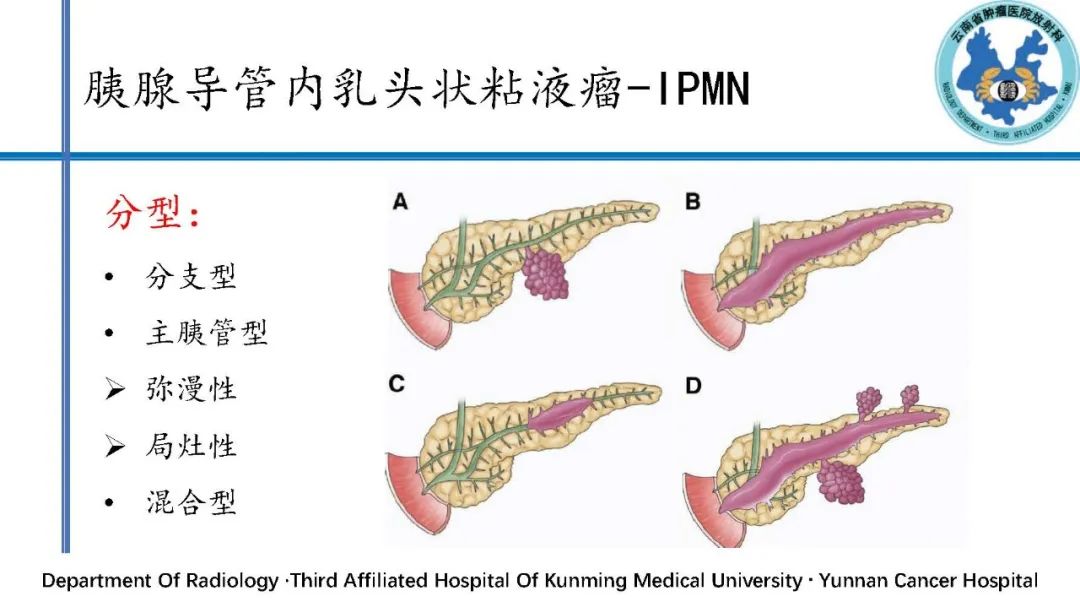 影像PPT - 【PPT】胰腺囊性病变诊断及处理策略-27