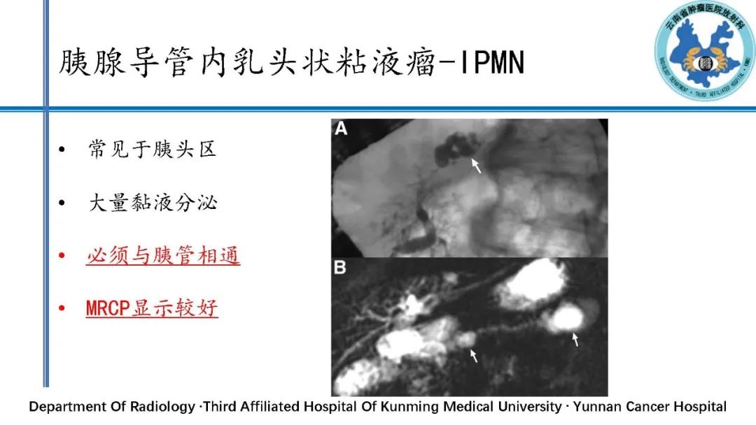 影像PPT - 【PPT】胰腺囊性病变诊断及处理策略-33