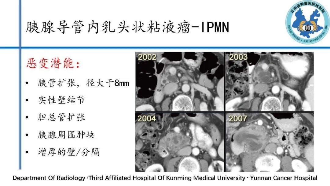 影像PPT - 【PPT】胰腺囊性病变诊断及处理策略-34