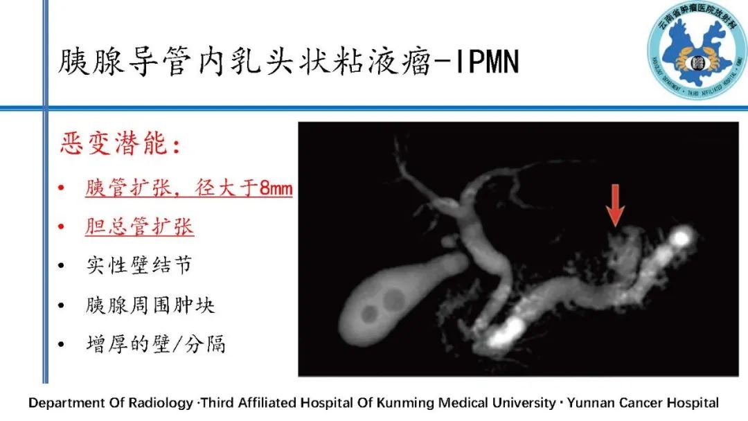 影像PPT - 【PPT】胰腺囊性病变诊断及处理策略-35