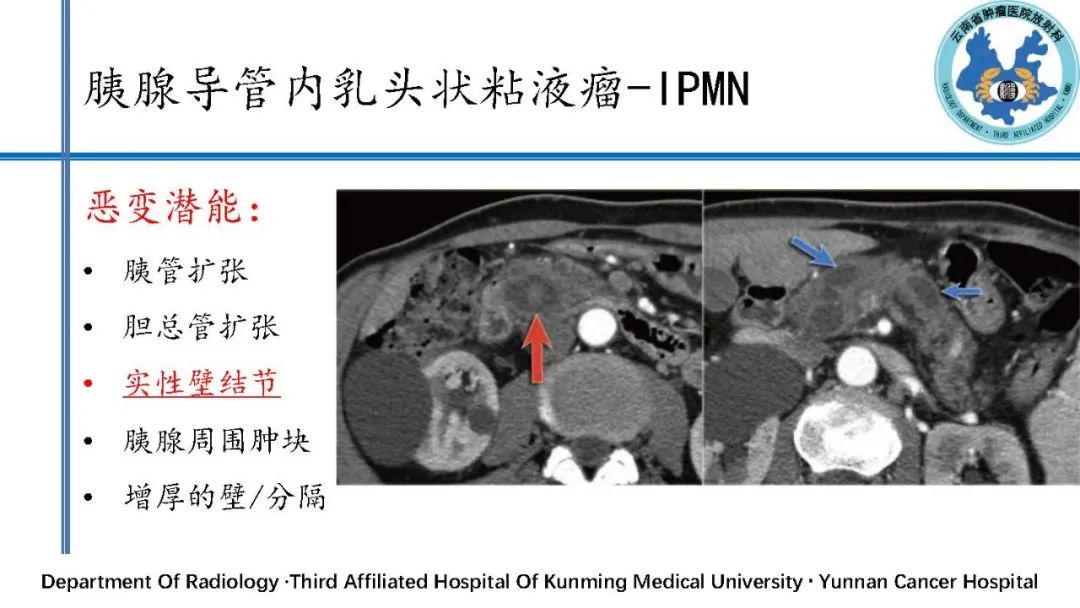 影像PPT - 【PPT】胰腺囊性病变诊断及处理策略-36