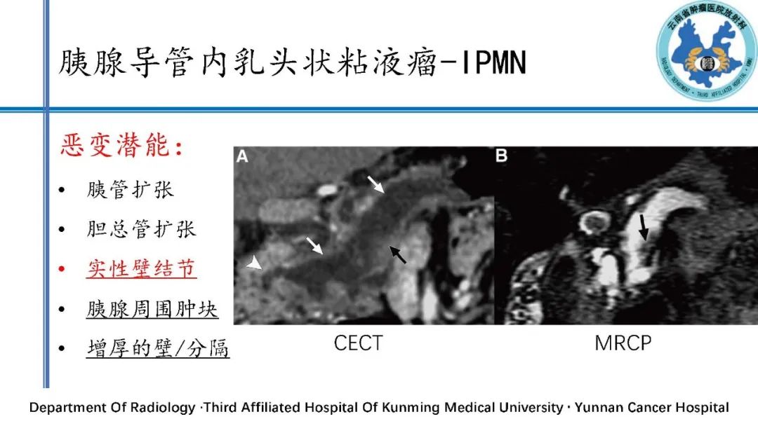 影像PPT - 【PPT】胰腺囊性病变诊断及处理策略-37