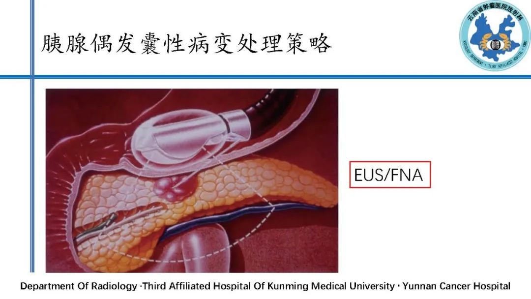 影像PPT - 【PPT】胰腺囊性病变诊断及处理策略-41