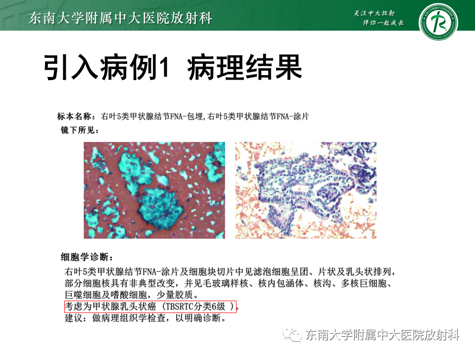 影像PPT - 【PPT】甲状腺乳头状癌的影像诊断-3