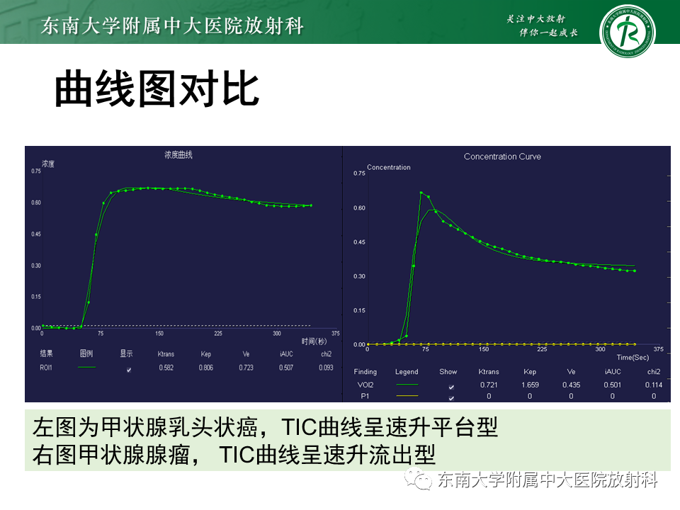 影像PPT - 【PPT】甲状腺乳头状癌的影像诊断-22