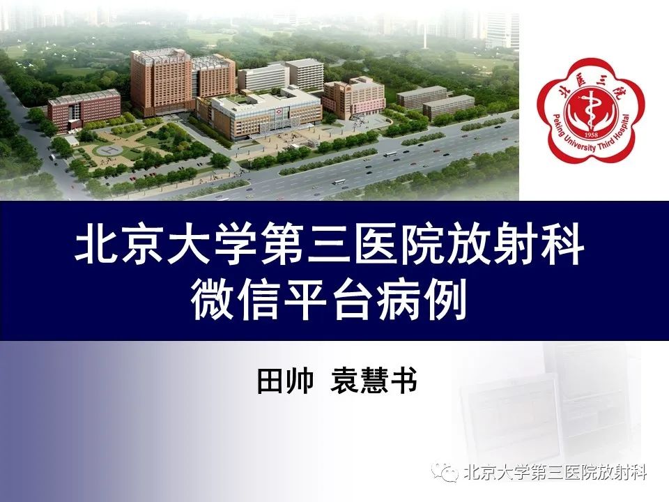 影像PPT - 【PPT】腕管综合征-1