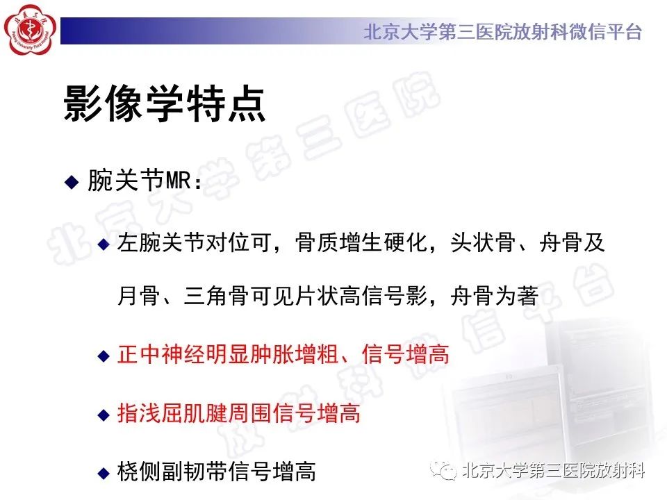 影像PPT - 【PPT】腕管综合征-5