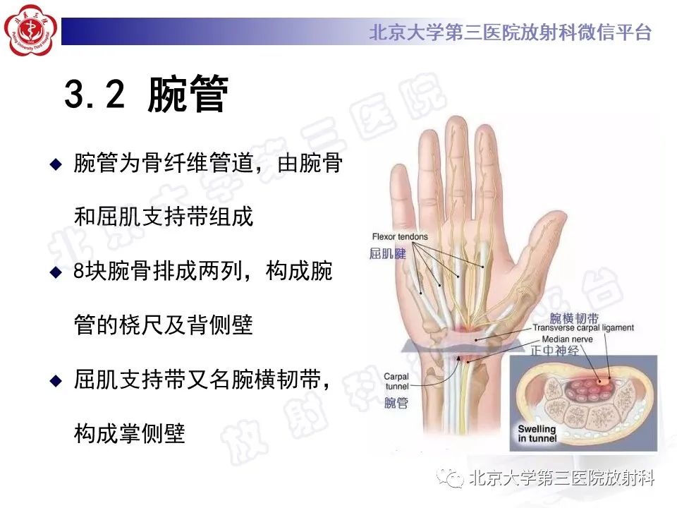 影像PPT - 【PPT】腕管综合征-13