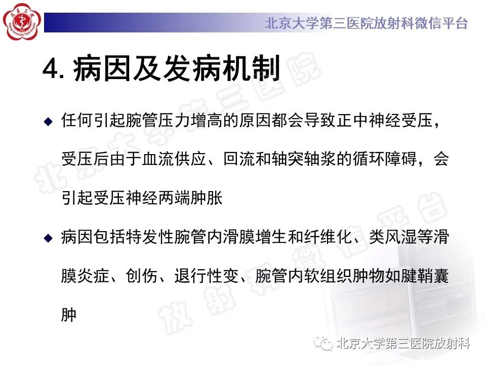 影像PPT - 【PPT】腕管综合征-16