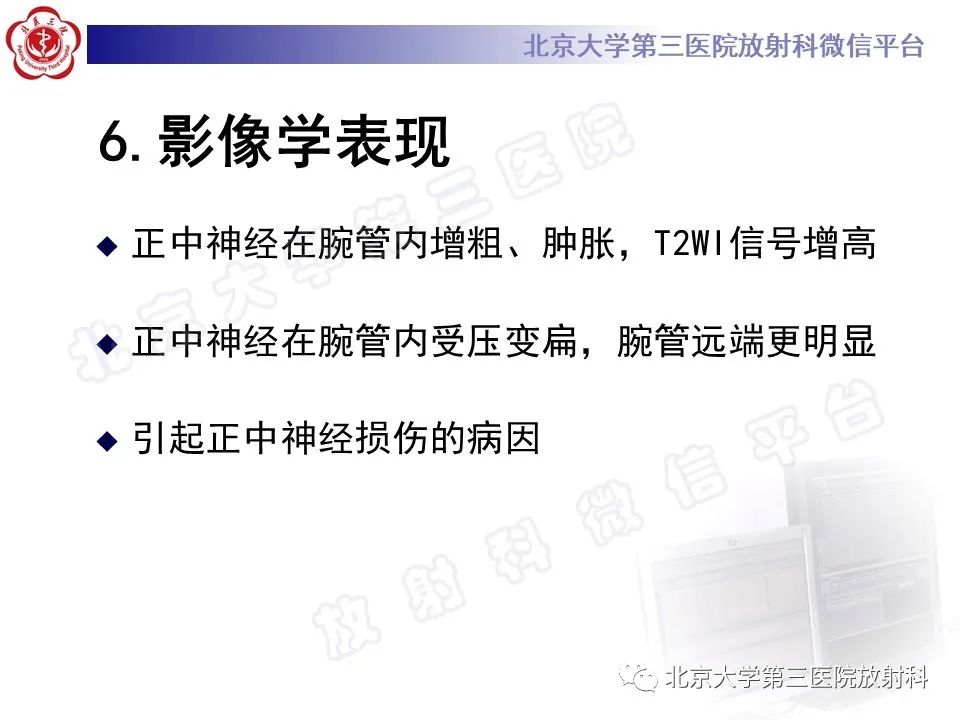 影像PPT - 【PPT】腕管综合征-1
