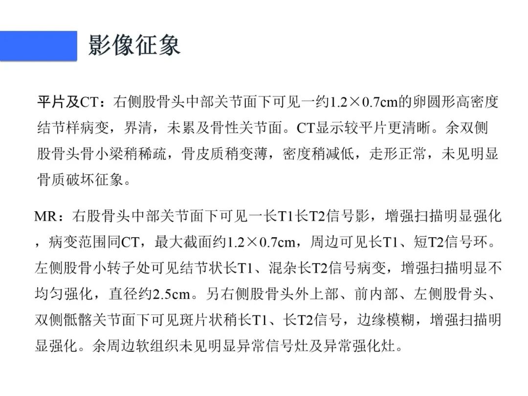 影像PPT - 【病例】磷酸盐尿性间叶性肿瘤1例影像学诊断思路-8