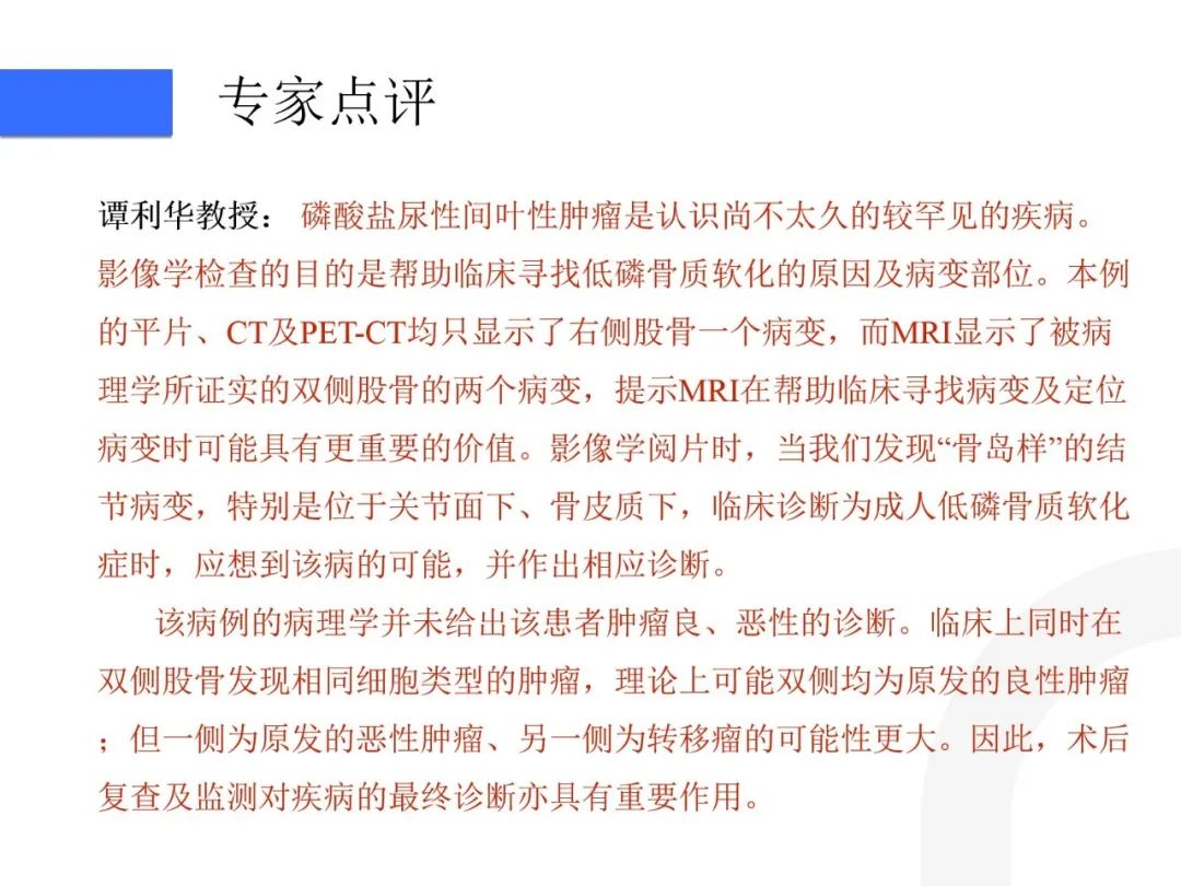 影像PPT - 【病例】磷酸盐尿性间叶性肿瘤1例影像学诊断思路-34